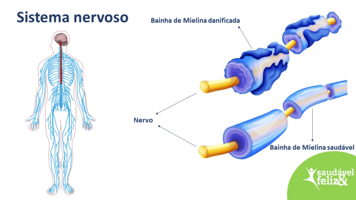Neuralgia neuralgia